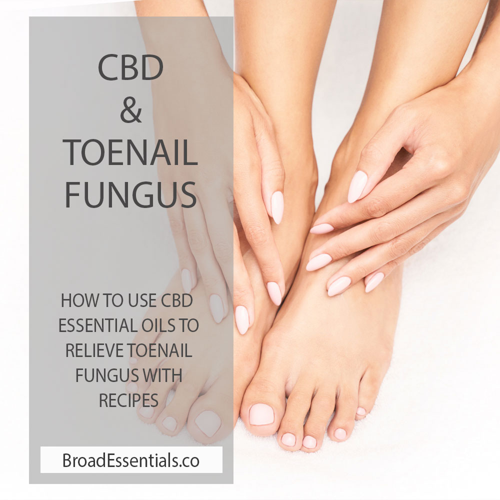 What is toe fungus and how can CBD oil help get rid of nail fungus and toenail fungus | Recipe and tips to get rid of Toenail Fungus