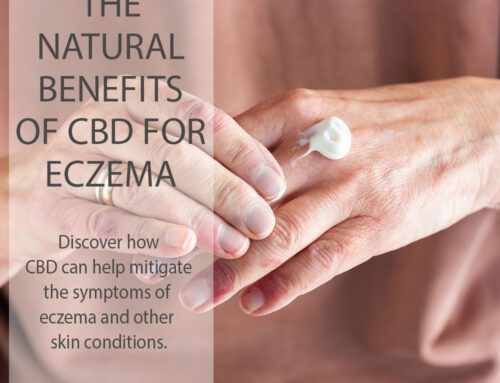 Using CBD for Eczema relief