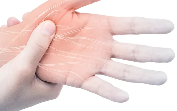 A man's hand with nerve pain.