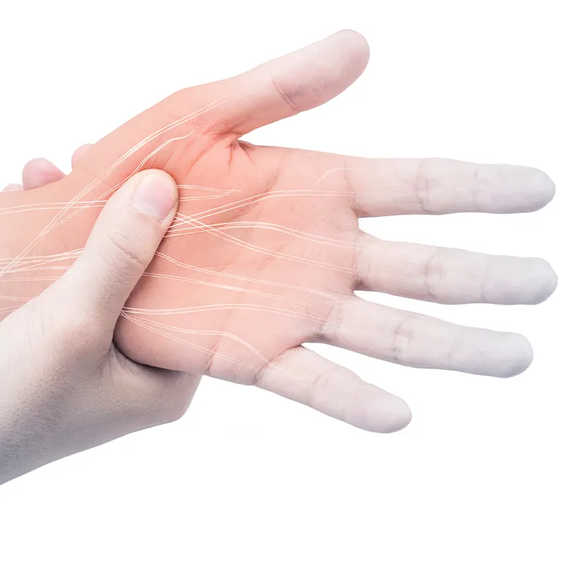 A man's hand with nerve pain.