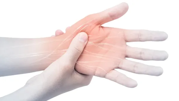 A man's hand with nerve pain.